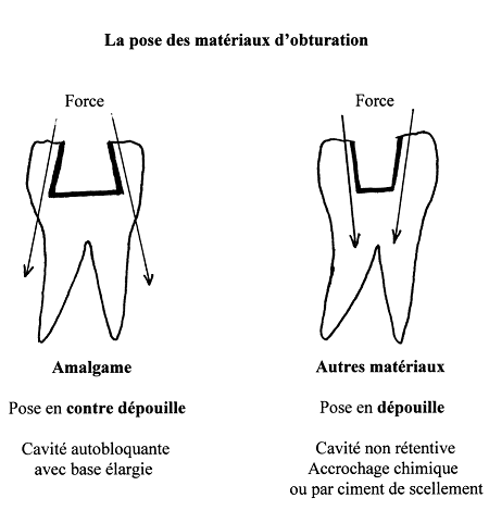 Les effets des métaux lourds sur l'environnement et la santé - Sénat